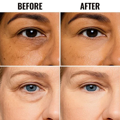 ✨ LAST DAY PROMOTION - BUY 2 GET 1 FREE✨ UNDER EYE BRIGHTENER